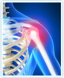 zajednički bol ramena zgloba s hip bol u zglobovima